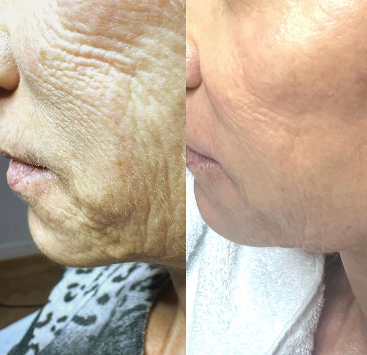 Allura Kollagen Maske