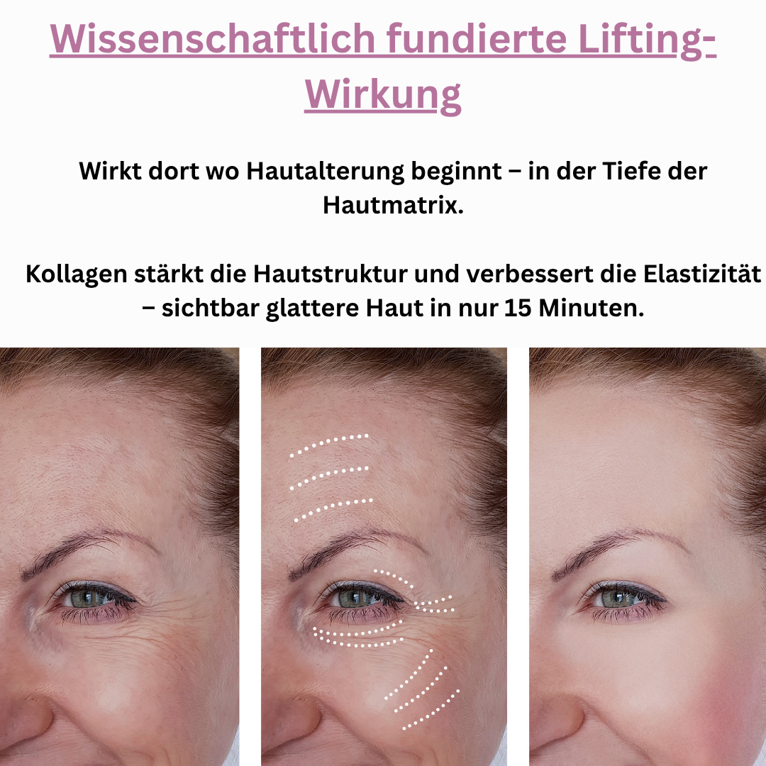 Allura Kollagen Masken  (Limited Edition)