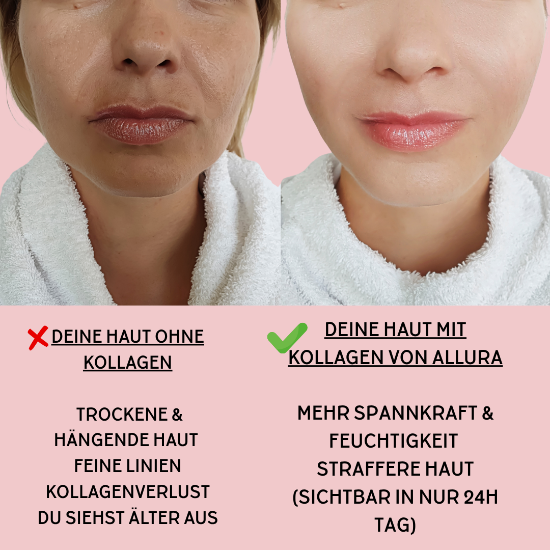 Allura Kollagen Masken  (Limited Edition)