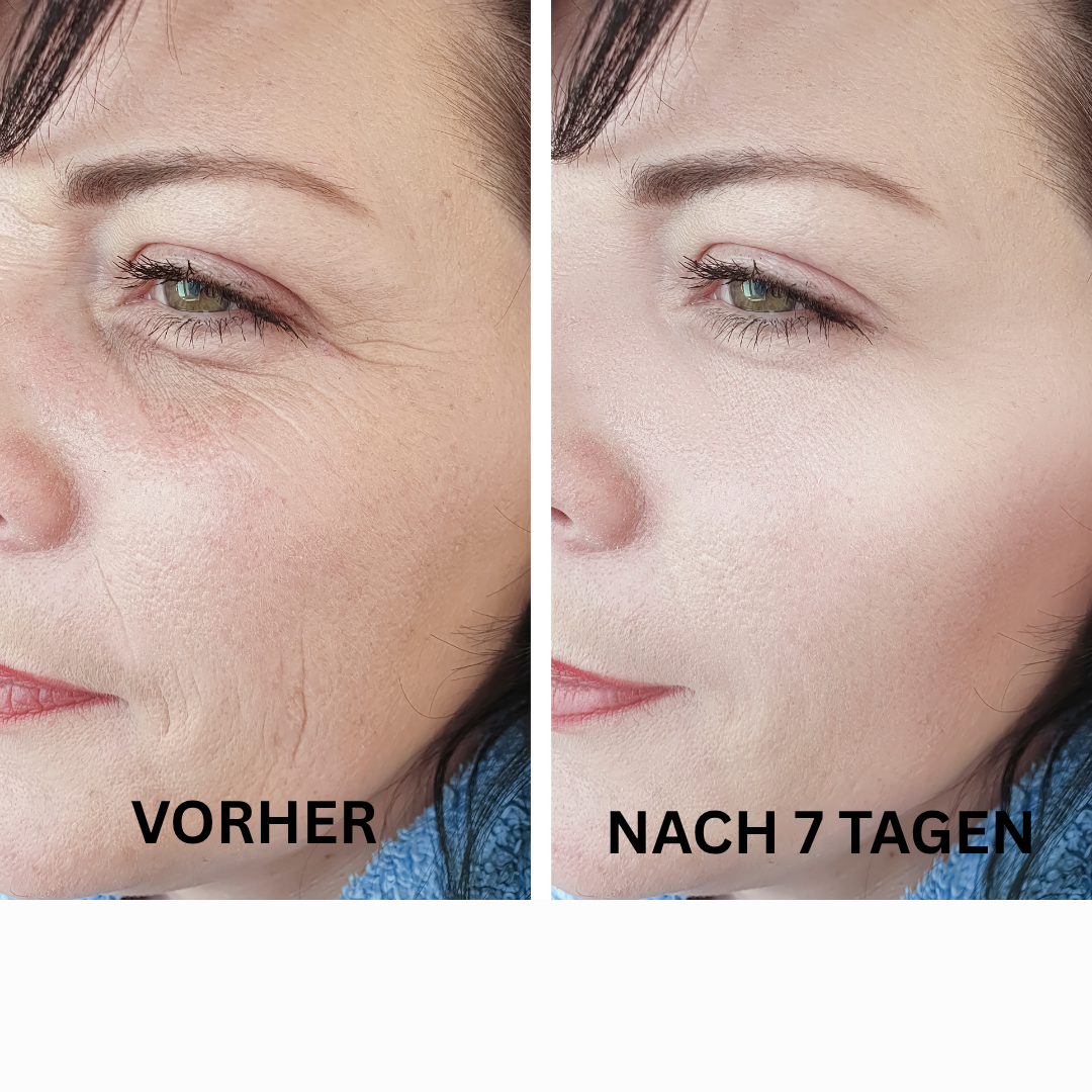 Allura Kollagen Masken  (Limited Edition)