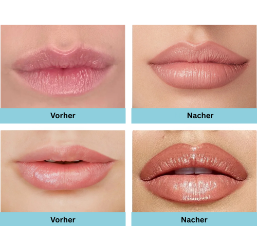 Allura Lip Liner