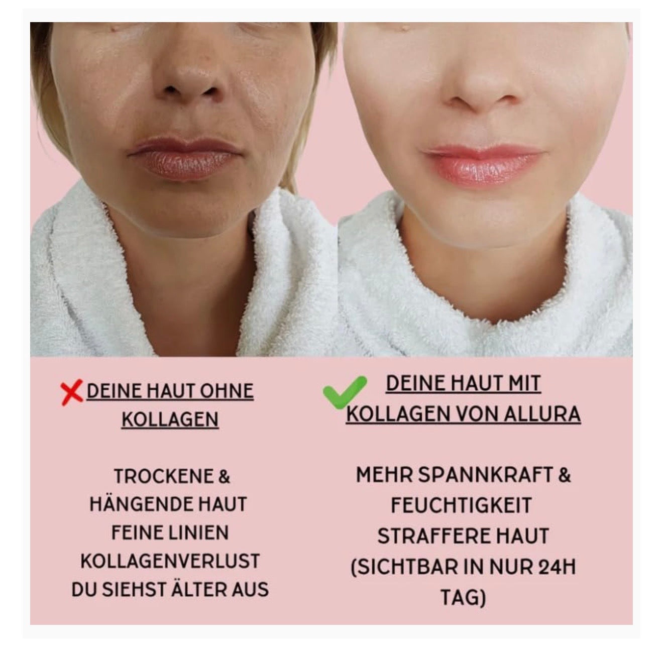 Allura Kollagen Maske