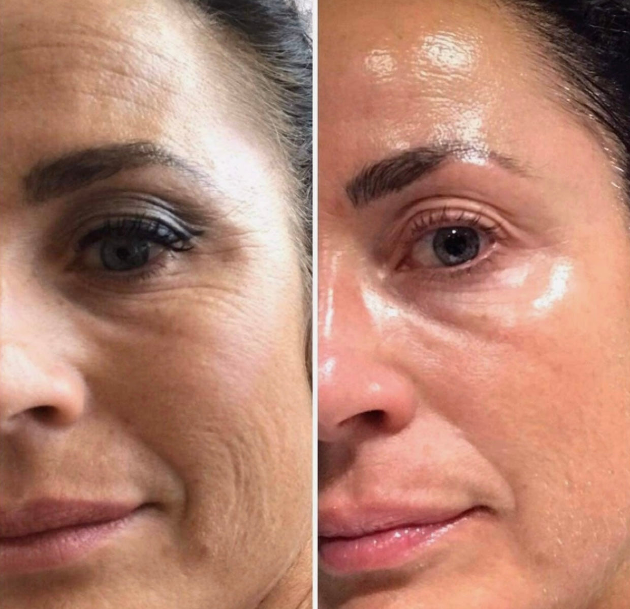 Allura Kollagen Maske
