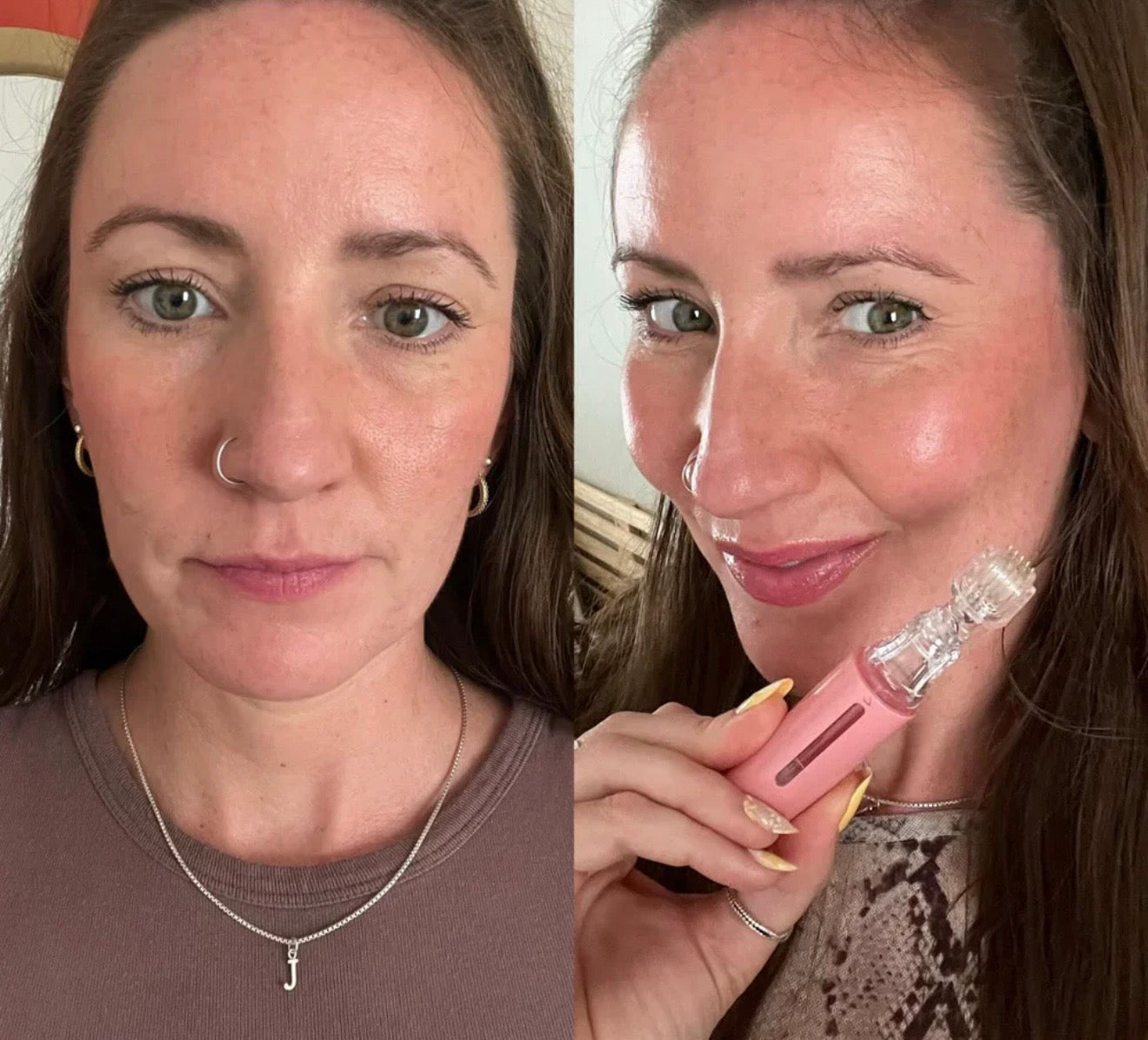 Allura Lip Booster Set